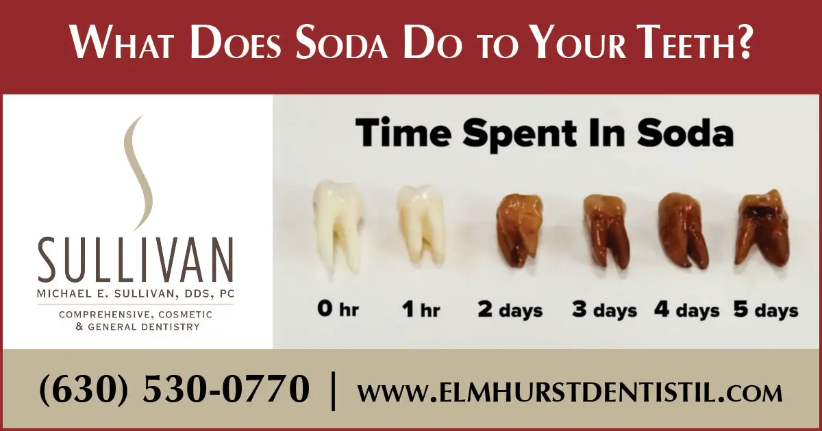 Why Does Coke Make My Teeth Feel Weird? Vending Business Machine Pro